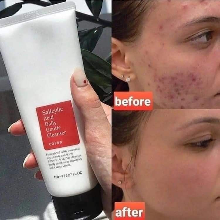 Cosrx Salicylic Acid Daily Gentle Cleanser Face Wash - 150ML