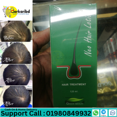 Neo Hair Lotion (Spray)- 120 ml