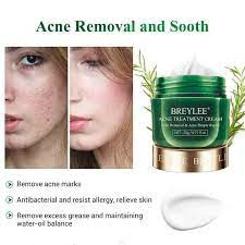 Breylee Acne Treatment Cream